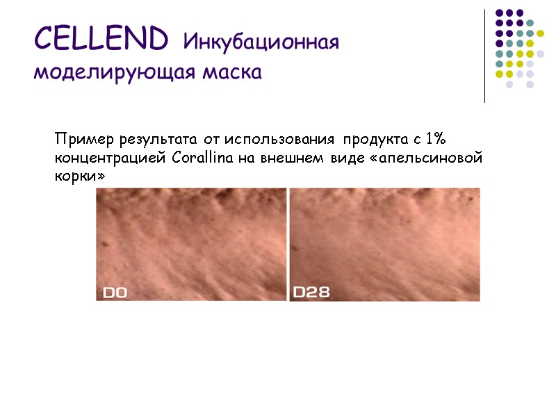Пример результата от использования продукта с 1% концентрацией Corallina на внешнем виде «апельсиновой корки»